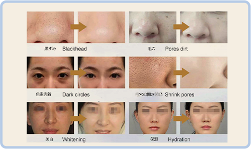 All in one Facial Treatment